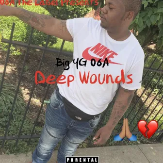 Deep Wounds by Big Yg 06A