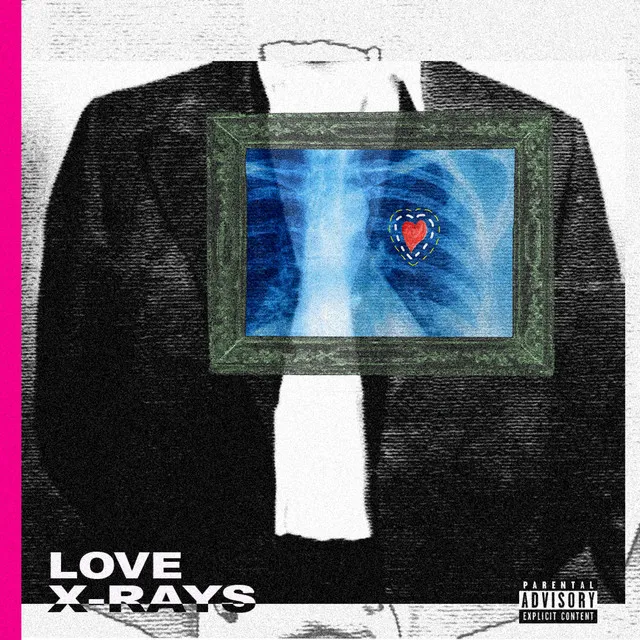 Love X-Rays