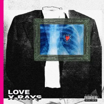 Love X-Rays by M*b*a*