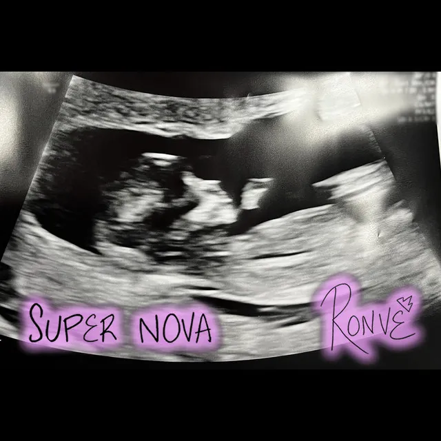 Super Nova