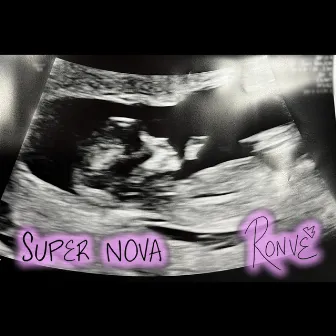 Super Nova by Ronve