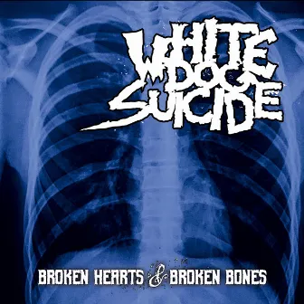 Broken Hearts & Broken Bones by White Dog Suicide