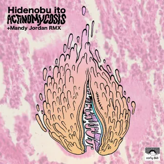 Actinomycosis EP by Hidenobu Ito