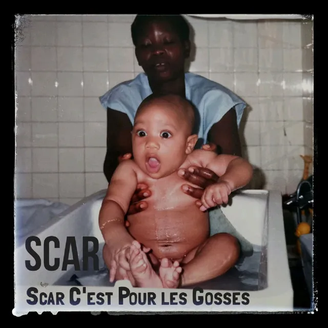 Scar c'est pour les gosses