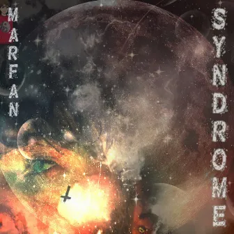 Marfan Syndrome by OMNEI