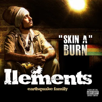 Skin a burn by Ilements