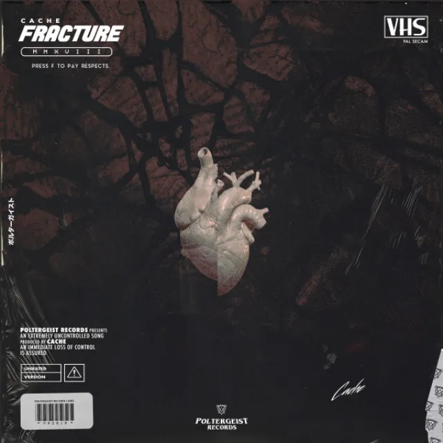 Fracture