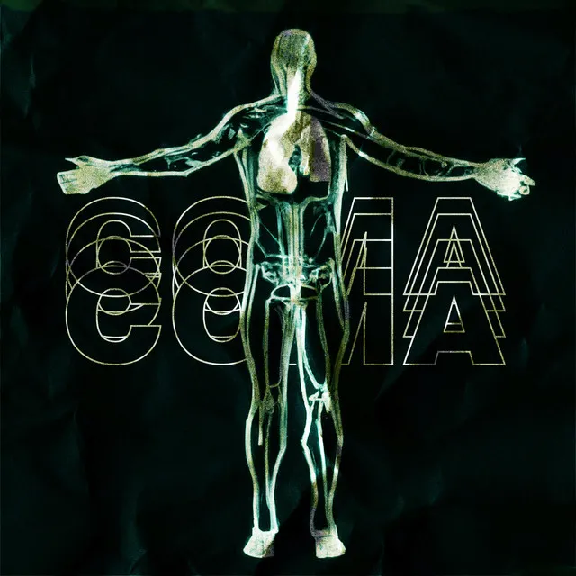 Coma