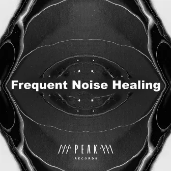 Frequent Noise Healing by Solfeggio Frequencies Healing