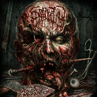 Exhumed Decollated Mutilation by Epicardiectomy