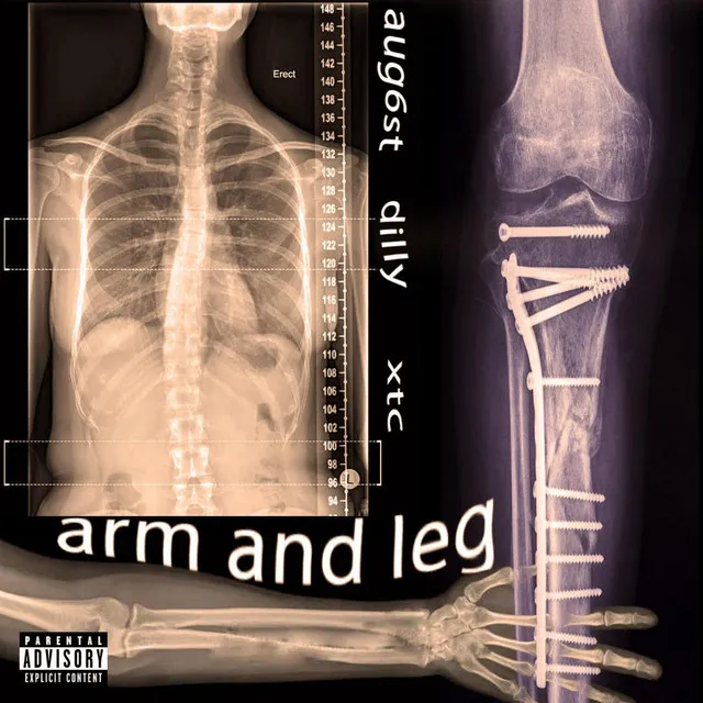 Arm and Leg