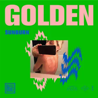 Sunburn by girl named GOLDEN