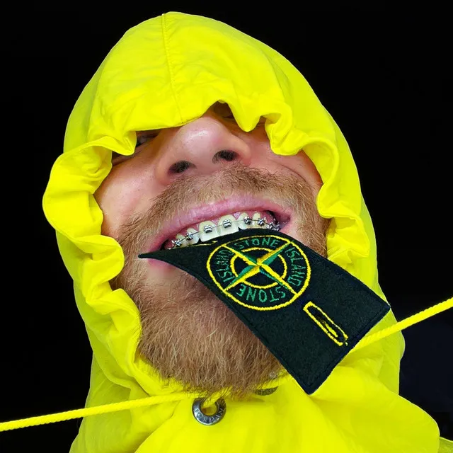 Запрети мне носить Stone Island (Супер версии)