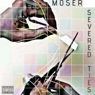 Severed Ties by Moser