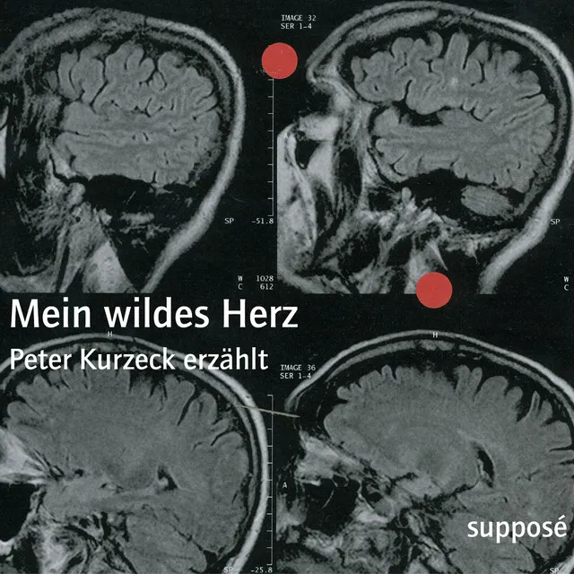 Mein wildes Herz I 1.1 - Mein wildes Herz