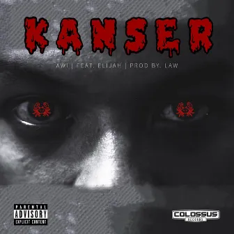 Kanser (feat. Elijah Borreros) by Awi Columna