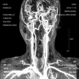 Head by Konsole