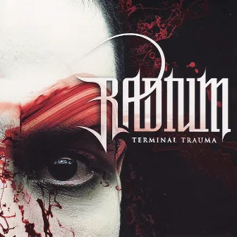 Terminal Trauma by Radium