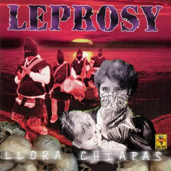 Llora Chiapas by Leprosy