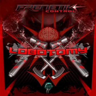 Lobotomy by Frenetik Control