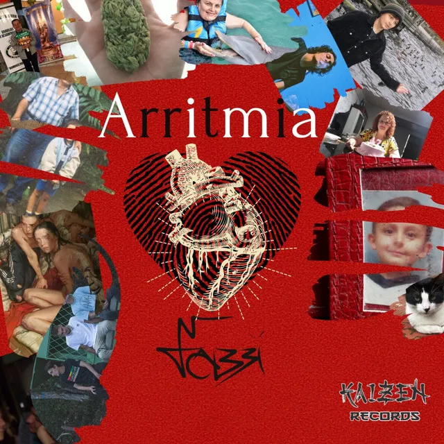 Arritmia