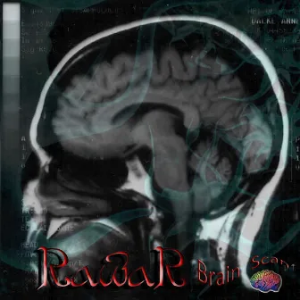 Brain Scan by Rawar