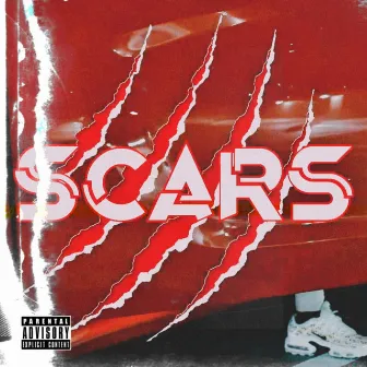 Scars by $now.