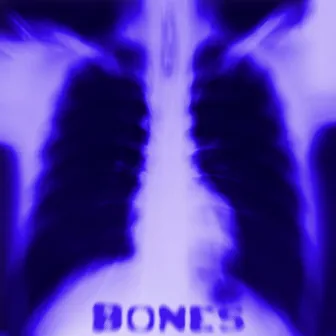 Bones by Nash Nash