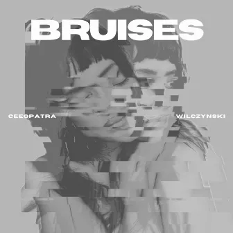 Bruises by Ceeopatra