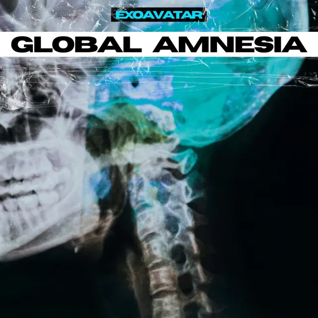 Global Amnesia