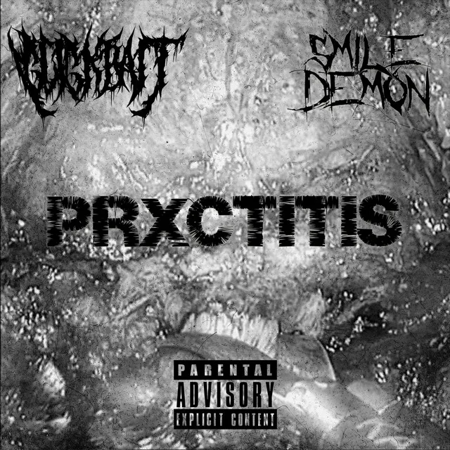 Prxctitis