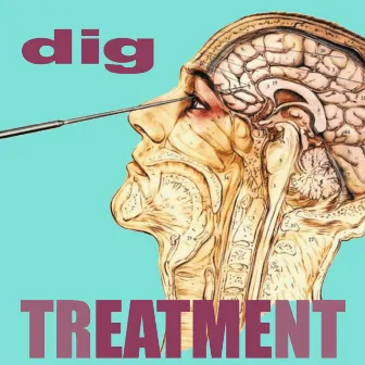 Treatment by Dig