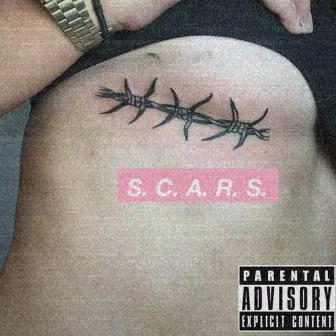 Scars by Kidd Fly