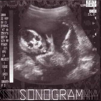 Sonogram by Saturday's Child