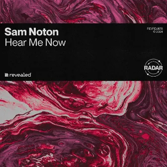 Hear Me Now by Sam Noton