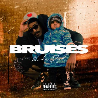 Bruises (Prod. by Mook Beatz) by Mike Dyl