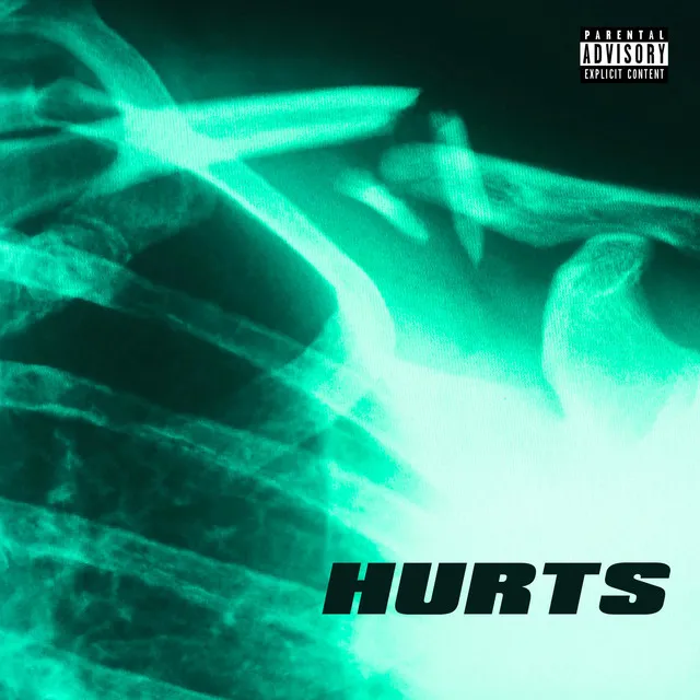 Hurts