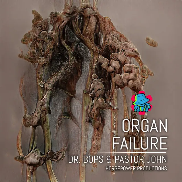 Organ Failure