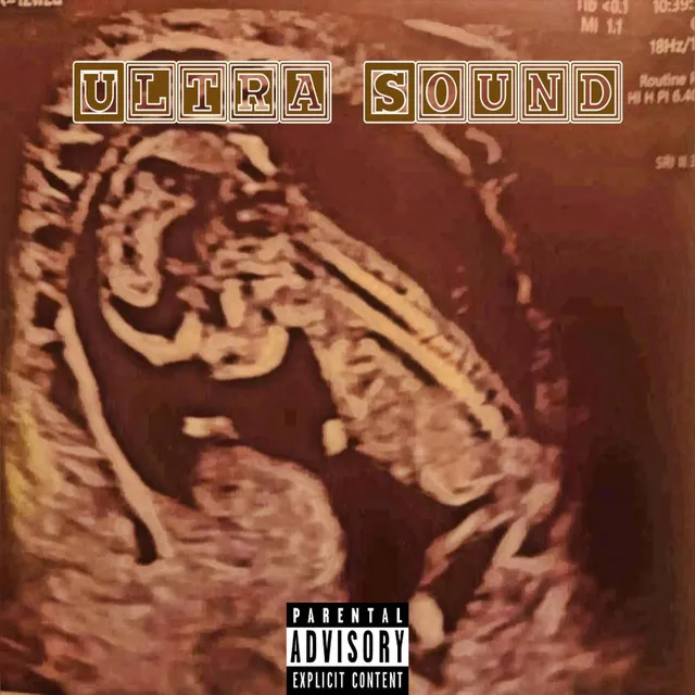 Ultra Sound