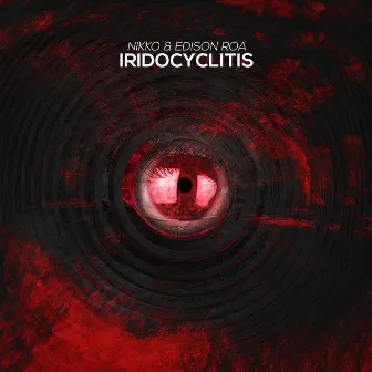 Iridocyclitis by Nikko