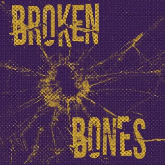 Broken Bones by Anna Saez