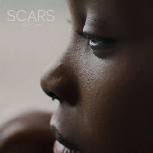 Scars