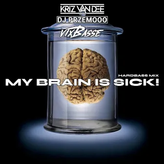 My Brain Is Sick! (Original Mix) by VixBasse