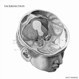 Face​|​Resection by Nicholas Deyoe