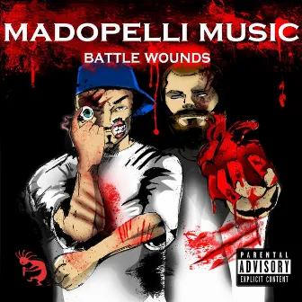 Battle Wounds by Madopelli