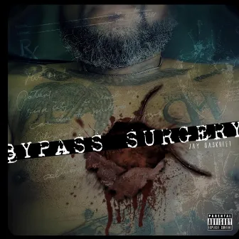 Bypass Surgery by Jay Daskreet