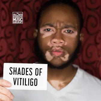 Shades of Vitiligo by Vinyal Crookz