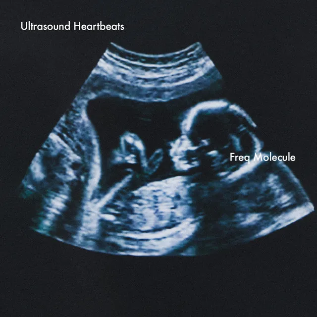 Ultrasound Heartbeats