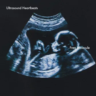 Ultrasound Heartbeats by Freq Molecule