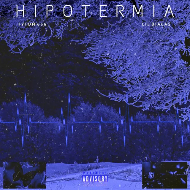 Hipotermia